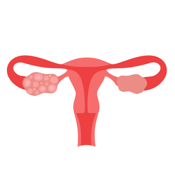 So You Think You Have Fibroids?