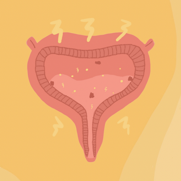 Chronic UTIs — The Secret Your Doctor Might Not Know to Tell You
