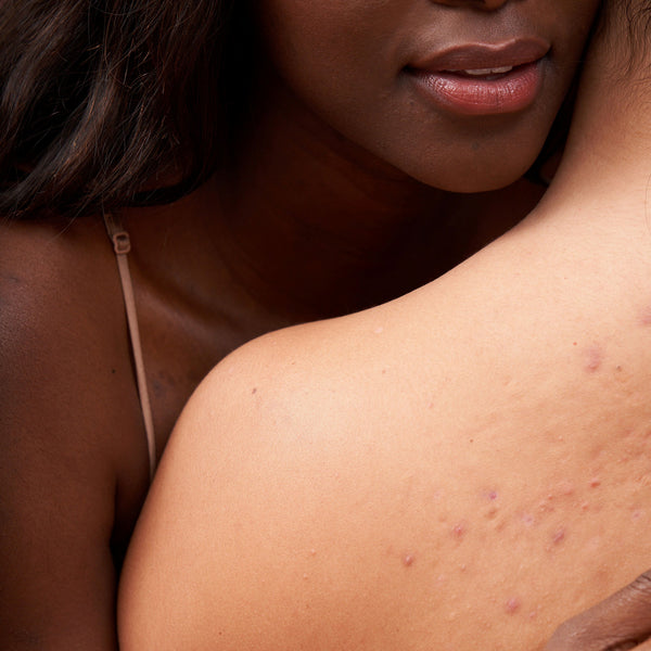 Tips on V and V Safe Sex